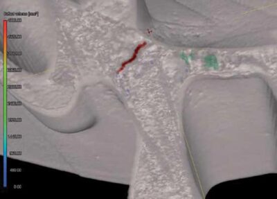 Industrial CT Scanning Examples - Exact Metrology
